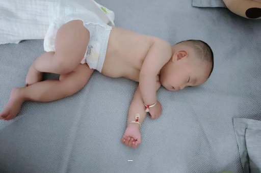 东方宝宝脸上有白色斑块